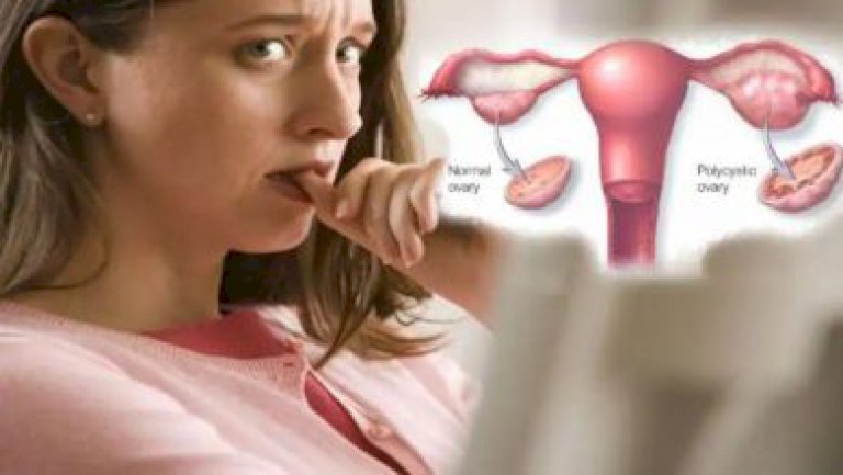 เบาหวานในผู้หญิง-:-ผู้หญิงควรเริ่มตรวจน้ำตาลในเลือดตั้งแต่อายุ-25-รู้สาเหตุ-–-nowtv